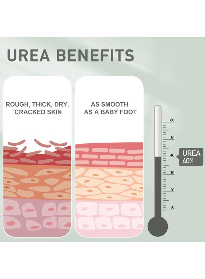 Mouriven Urea Cream 40 Percent - Foot & Hand Cream for Dry, Cracked Heels, Feet, Knees, Elbows, and Hands - Maximum Strength Urea Lotion for Softening and Moisturizing - Image 3
